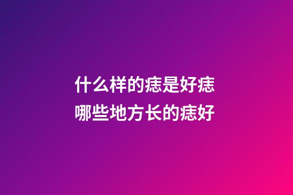 什么样的痣是好痣 哪些地方长的痣好